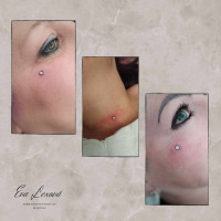 /album/fotogalerie-piercing/microdermalni-sperk-oblicej-jpg/
